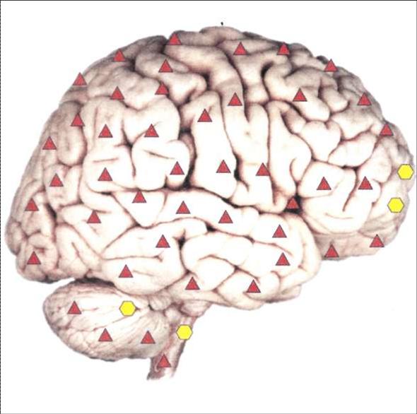 Мозг справа - нормальная работа головного мозга.
