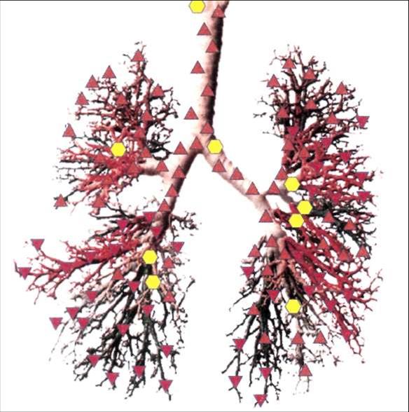 Трахея и бронхиальное дерево - предрасположенность к развитию бронхиальной астмы.